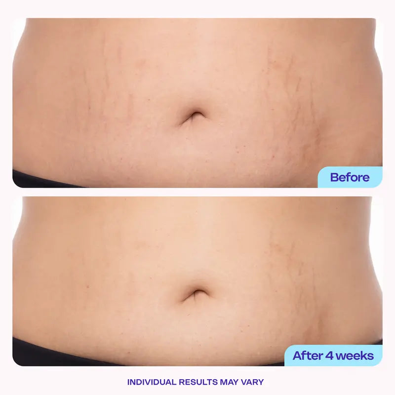 (New!) GOPURE Tighten & Smooth Belly Firming Cream