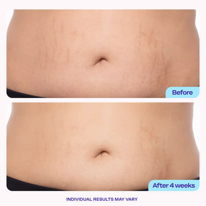 (New!) GOPURE Tighten & Smooth Belly Firming Cream